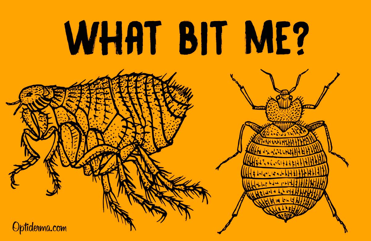 Flea Bites Vs Bed Bugs All You Need Infos