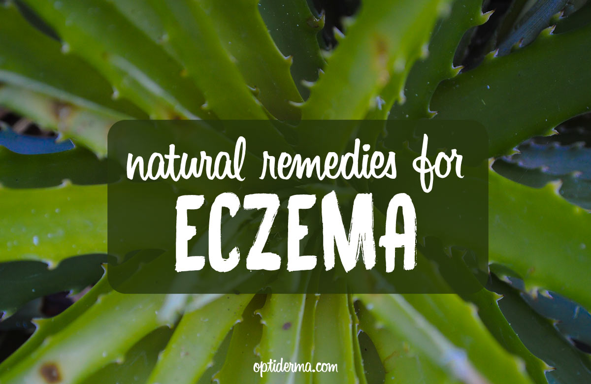 Eczema: How to Heal Skin Rashes with Natural Treatments?