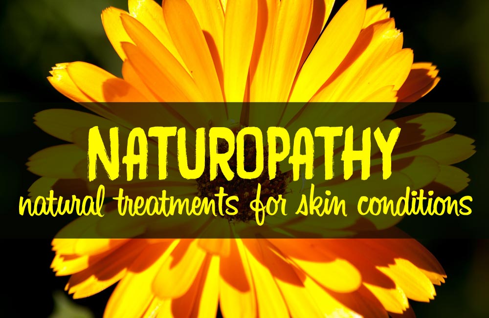 Treating skin conditions with naturopathy - Optiderma