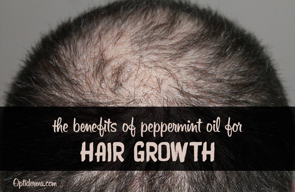 Peppermint Oil For Hair Loss A Powerful Treatment To Encourage